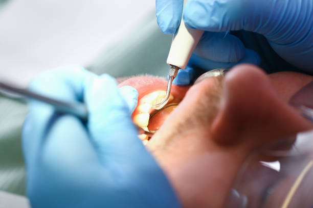 Best Emergency Dental Care for Abscessed Tooth in Marcus Hook, PA