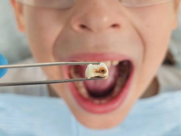 Best Orthodontic Emergency Dentist in Marcus Hook, PA